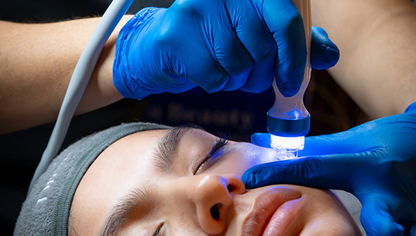 Radiofrecuencia Facial